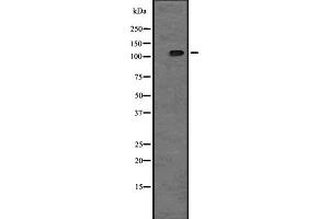 Western blot analysis of TAOK2 expression in A431 whole cell lysate ,The lane on the left is treated with the antigen-specific peptide. (TAO Kinase 2 Antikörper  (Internal Region))