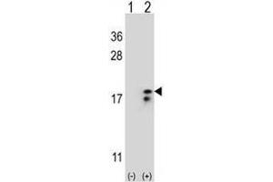 Western blot analysis of COX6A1 (arrow) using rabbit polyclonal COX6A1 Antibody (Center) . (Complex IV Subunit VIaL (AA 57-86), (Middle Region) Antikörper)