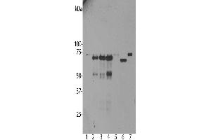 Western blot analysis of untransfected primary mouse neuron and glia cell cultures (lane 1), the same cells transduced with human ubiquilin 2 wild type (lane 2), with ubiquilin 2 P506T mutant (lane 3), with ubiquilin 2 P497S mutant (lane 4) and with enhanced GFP control (lane 5), all probed with ABIN1580461.