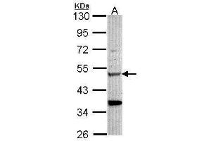 WB Image Sample (30 ug of whole cell lysate) A: Hela 10% SDS PAGE antibody diluted at 1:1000 (Chitotriosidase 1 Antikörper)