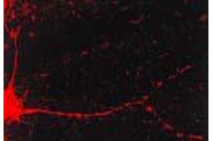 CamKII (6G9) in cultured cortical neurons. (CAMKII gamma Antikörper)