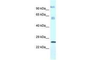 Image no. 1 for anti-Transmembrane Protein 222 (TMEM222) (AA 106-155) antibody (ABIN6747477) (TMEM222 Antikörper  (AA 106-155))