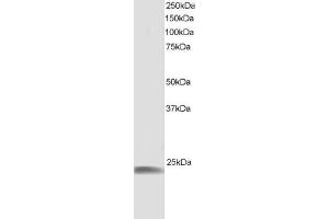 ABIN184852 staining (1µg/ml) of human muscle lysate (RIPA buffer, 30µg total protein per lane). (HSPB8 Antikörper  (C-Term))