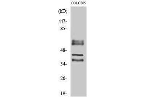 Western Blotting (WB) image for anti-Periphilin 1 (PPHLN1) (Internal Region) antibody (ABIN3186395) (PPHLN1 Antikörper  (Internal Region))