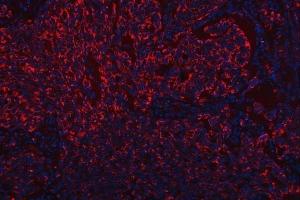 IF analysis of Scavenging Receptor SRB2/SCARB2 using anti-Scavenging Receptor SRB2/SCARB2 antibody (ABIN7601833).