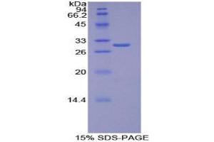 SDS-PAGE (SDS) image for Torsin Family 1, Member B (Torsin B) (TOR1B) (AA 98-327) protein (His tag) (ABIN2127024)