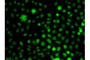 Immunofluorescence analysis of A549 cell using UBE2R2 antibody.
