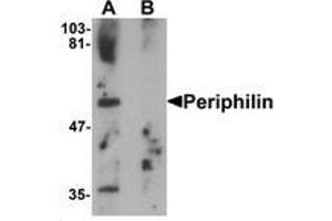 Western blot analysis of Periphilin in mouse colon tissue lysate with Periphilin Antibody   at 1 ug/mL in (A) the absence and (B) the presence of blocking peptide. (PPHLN1 Antikörper  (Middle Region))