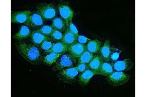 IF analysis of OXCT1/SCOT using anti-OXCT1/SCOT antibody (ABIN7601419). (OXCT1 Antikörper  (AA 35-309))