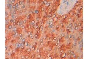 Immunohistochemistry (IHC) image for anti-Phosphoglycolate Phosphatase (PGP) (AA 81-321) antibody (ABIN7444388)