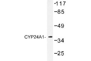 Image no. 1 for anti-Cytochrome P450, Family 24, Subfamily A, Polypeptide 1 (CYP24A1) antibody (ABIN272271) (CYP24A1 Antikörper)