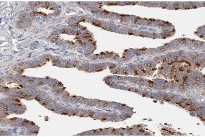 ABIN6266939 at 1/100 staining human Fallopian tube tissue sections by IHC-P. (DLEC1 Antikörper  (N-Term))