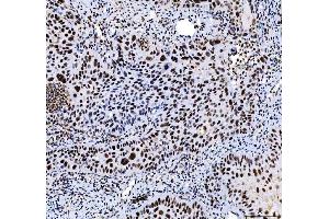 IHC analysis of HDAC2 using anti-HDAC2 antibody (ABIN7601564). (HDAC2 Antikörper  (AA 387-488))