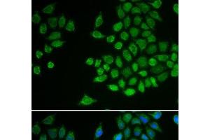 Immunofluorescence analysis of MCF-7 cells using PTPN2 Polyclonal Antibody (PTPN2 Antikörper)