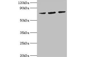 Western blot All lanes: HSPA6 antibody at 2 μg/mL Lane 1: MCF-7 whole cell lysate Lane 2: A431 whole cell lysate Lane 3: Jurkat whole cell lysate Secondary Goat polyclonal to rabbit IgG at 1/10000 dilution Predicted band size: 72 kDa Observed band size: 72 kDa (HSPA6 Antikörper  (AA 1-637))