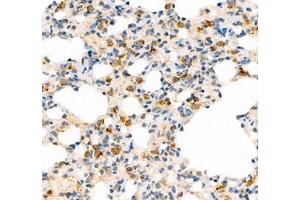 Immunohistochemistry (Paraffin-embedded Sections) (IHC (p)) image for anti-Adhesion Molecule with Ig-Like Domain 2 (AMIGO2) antibody (ABIN7072966)