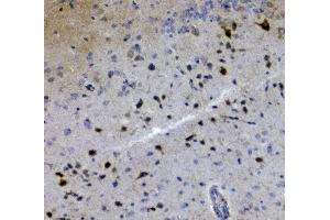 IHC analysis of GRIK1 using anti-GRIK1 antibody (ABIN3042430).