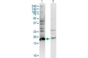 Western Blot analysis of BTF3L4 expression in transfected 293T cell line by BTF3L4 monoclonal antibody (M05), clone 2G10. (BTF3L4 Antikörper  (AA 1-158))
