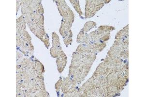 Immunohistochemistry of paraffin-embedded Mouse heart using HBA2 Polyclonal Antibody at dilution of 1:100 (40x lens). (HBa2 Antikörper)