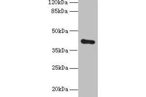 Western blot All lanes: ZDHHC4 antibody at 1. (ZDHHC4 Antikörper  (AA 277-344))
