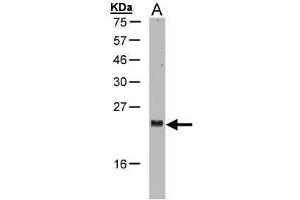 WB Image Sample(30 μg of whole cell lysate) A:H1299 15% SDS PAGE antibody diluted at 1:1000 (ARL2 Antikörper  (C-Term))