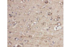 Immunohistochemistry (IHC) image for anti-Ephrin Type A Receptor 1 (EPHA1) (C-Term) antibody (ABIN3030829)