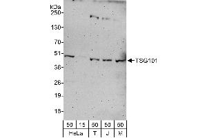Western Blotting (WB) image for anti-Tumor Susceptibility Gene 101 (TSG101) (AA 300-350) antibody (ABIN7453231)