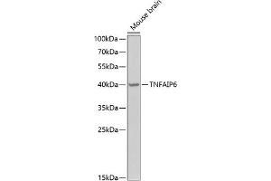 Western blot analysis of extracts of mouse brain, using TNF Antibody (ABIN6130740, ABIN6149294, ABIN6149295 and ABIN6222057) at 1:1000 dilution. (TNFAIP6 Antikörper  (AA 18-277))