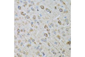 Immunohistochemistry of paraffin-embedded rat brain using CRYM antibody. (CRYM Antikörper  (AA 1-314))
