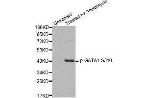 Western Blotting (WB) image for anti-GATA Binding Protein 1 (Globin Transcription Factor 1) (GATA1) (pSer310) antibody (ABIN1870204) (GATA1 Antikörper  (pSer310))