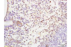 Formalin-fixed and paraffin embedded rat uterus tissue labeled with Anti-SHBG Polyclonal Antibody, Unconjugated at 1:200 followed by conjugation to the secondary antibody and DAB staining (SHBG Antikörper  (AA 301-402))