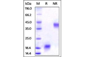 Human VEGF110 on SDS-PAGE under reducing (R) and no-reducing (NR) conditions. (VEGF110 (AA 27-136) (Active) Protein)
