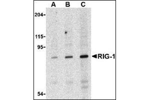 Western blot analysis of RIG-1 in C2C12 cell lysate with this product at (A) 0.