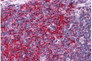 Human Thymus: Formalin-Fixed, Paraffin-Embedded (FFPE) (EFHD2 Antikörper  (N-Term))