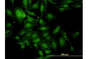 Immunofluorescence of monoclonal antibody to TSC22D1 on HeLa cell. (TSC22D1 Antikörper  (AA 1-144))