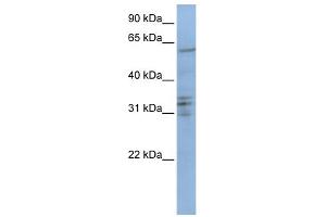 WB Suggested Anti-CENPB Antibody Titration: 0. (CENPB Antikörper  (C-Term))
