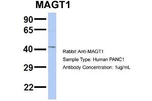 Host: Rabbit Target Name: MAGT1 Sample Type: PANC1 Antibody Dilution: 1. (MAGT1 Antikörper  (N-Term))