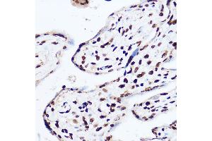 Immunohistochemistry (IHC) image for anti-O-Linked N-Acetylglucosamine (GlcNAc) Transferase (UDP-N-Acetylglucosamine:polypeptide-N-Acetylglucosaminyl Transferase) (OGT) (AA 857-1036) antibody (ABIN3022708)