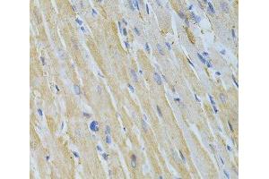 Immunohistochemistry of paraffin-embedded Rat heart using NME1 Polyclonal Antibody at dilution of 1:200 (40x lens). (NME1 Antikörper)