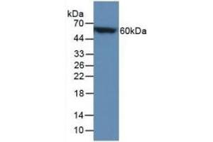 Detection of Recombinant CALB, Mouse using Polyclonal Antibody to Calbindin (CALB) (CALB1 Antikörper  (AA 3-261))