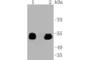 Lane 1: 293 lysates, Lane 2: F9 lysates probed with p53(S392) (3A1) Monoclonal Antibody  at 1:1000 overnight at 4˚C. (p53 Antikörper  (pSer392))