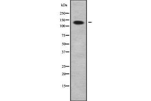 Western blot analysis of ADAMTS2 using COLO205 whole cell lysates (Adamts2 Antikörper  (Internal Region))