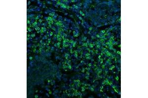 anti-HLA-DR-gamma (CD74) (N-Term) antibody