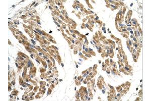 SLC35F2 antibody was used for immunohistochemistry at a concentration of 4-8 ug/ml.