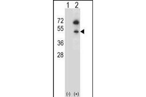 Western blot analysis of GNAS (arrow) using rabbit polyclonal GNAS Antibody (C-term) (ABIN656989 and ABIN2850497). (GNAS Antikörper  (C-Term))