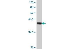 Western Blot detection against Immunogen (37. (TRIM13 Antikörper  (AA 1-100))
