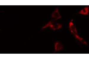 Immunofluorescence (fixed cells) (IF/ICC) image for anti-SHC (Src Homology 2 Domain Containing) Transforming Protein 1 (SHC1) (pTyr427) antibody (ABIN6255915)