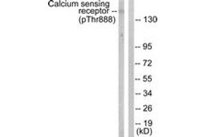 Western blot analysis of extracts from LOVO cells, using Calcium Sensing Receptor (Phospho-Thr888) Antibody. (CASR Antikörper  (pThr888))