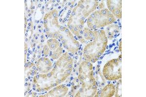 Immunohistochemistry of paraffin-embedded mouse kidney using HD antibody (ABIN3022456, ABIN3022457, ABIN3022458 and ABIN6218830) at dilution of 1:100 (40x lens). (HDAC6 Antikörper  (AA 1-200))