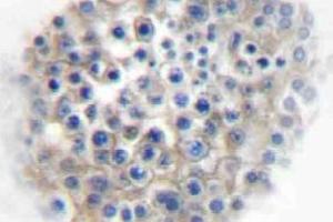 Immunohistochemistry (IHC) analyzes of AR alpha2A antibody in paraffin-embedded human testis tissue. (ADRA2A Antikörper)